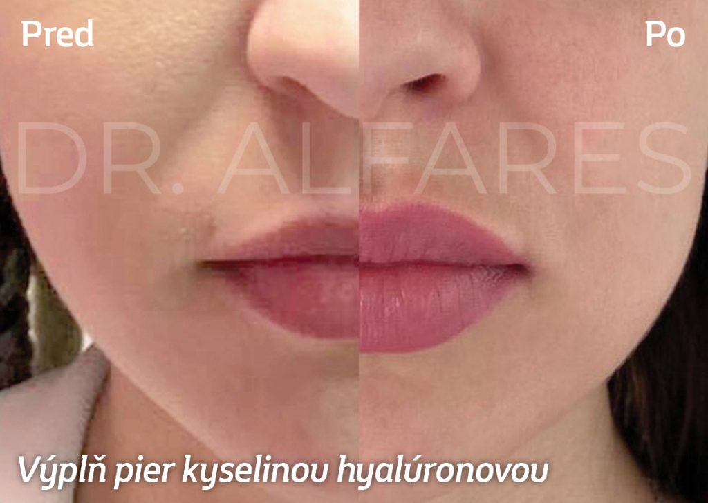 krasa, mladost, zdraví, biothecare, printovemedia, precitaj.online, botox, omladenie, dlhovekost