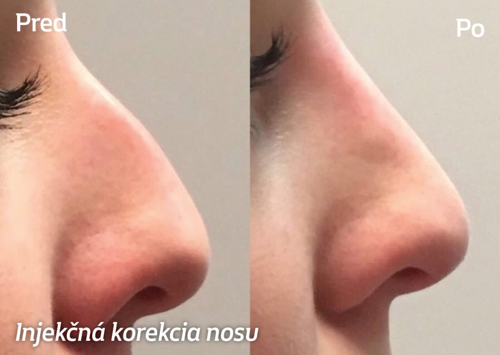 krasa, mladost, zdraví, biothecare, printovemedia, precitaj.online, botox, omladenie, dlhovekost